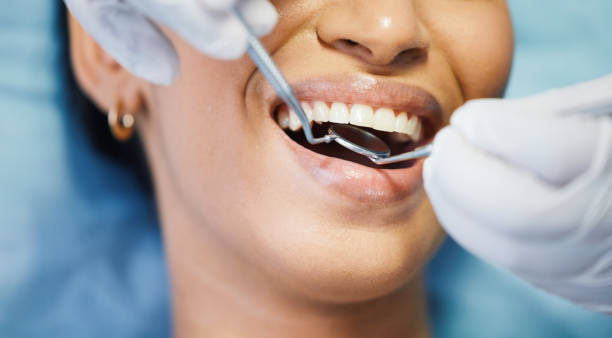 Best Broken or Chipped Tooth Repair in Elwood, IL
